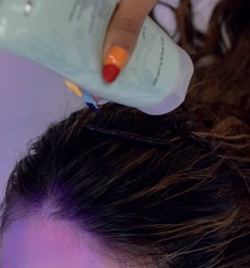 Tratamiento-Glossynation